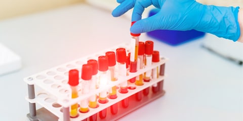 Drug Screening and Confirmation
