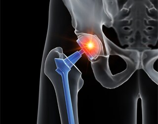 Testing, Analysis and Inspection of Biomaterials and Prosthetics