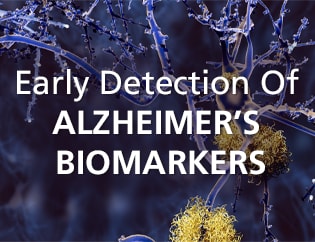AMYLOID MS Service for Alzheimer’s Research