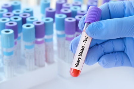 Forensic Toxicology Heavy Metals Analysis