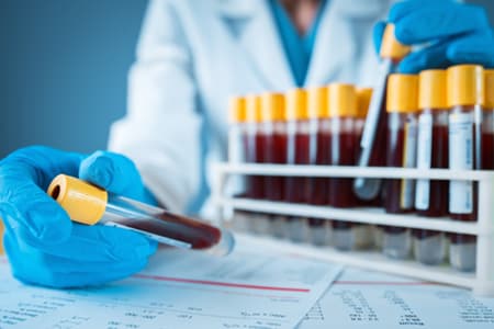 Forensic Toxicology