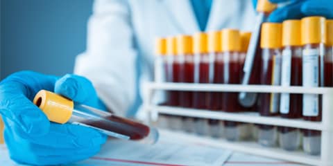 Forensic Toxicology