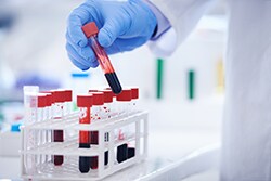 Forensics Volatile Drug Screening Blood Test