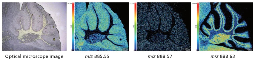 Measurement Results for the Cerebellum with 5 μm Spatial Resolution