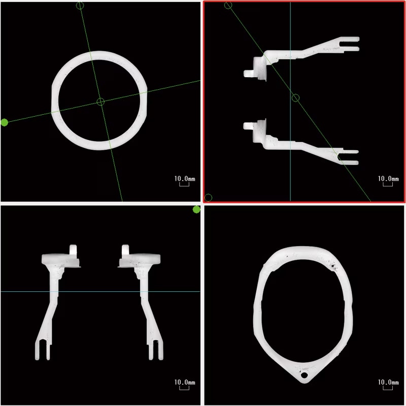 Aluminum Die Castings MPR Image