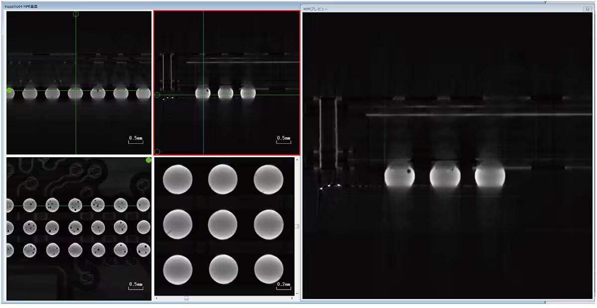 Ball Grid Array (BGA) MPR Image FOV = ø5 mm