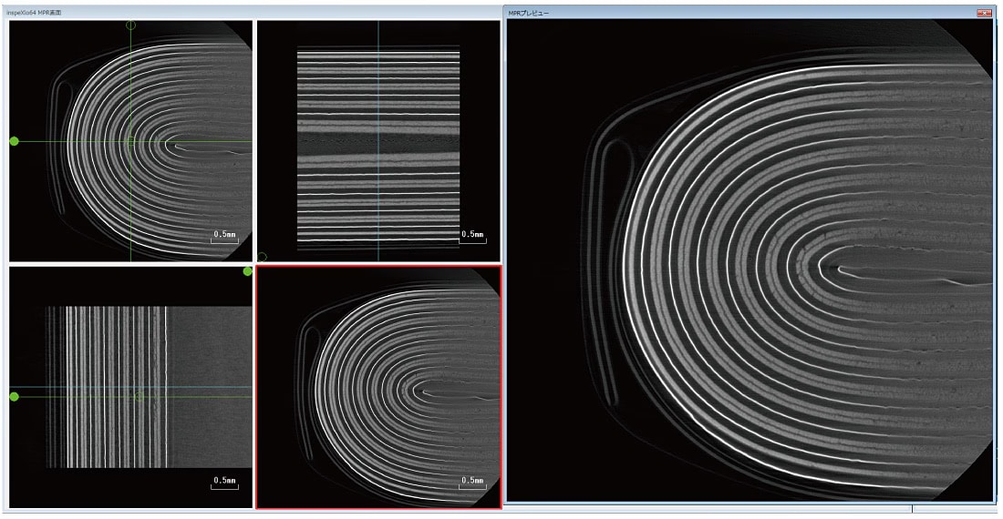 Circuit Board MPR Image FOV = ø 4.4 mm
