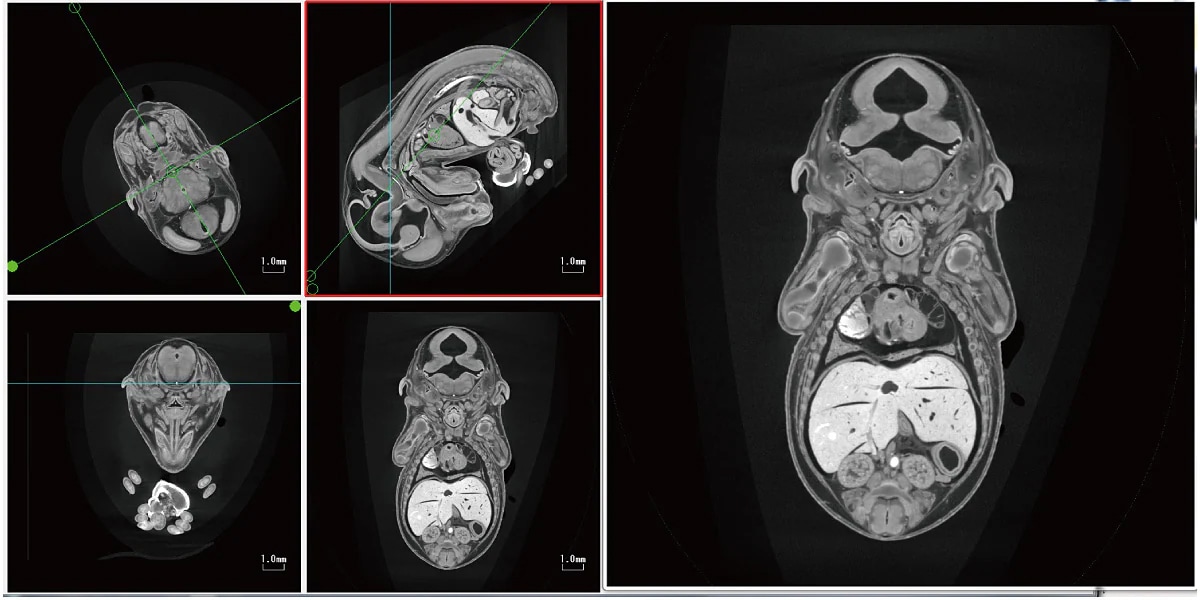 Mouse Fetus MPR Image FOV = ø 13.7 mm