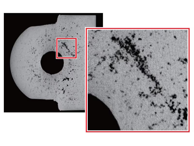 High-Resolution CT Image