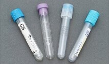 Sample Vials